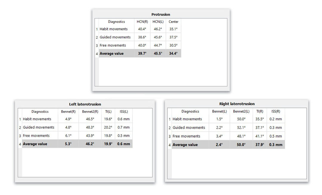 Jaw Motion Calculation