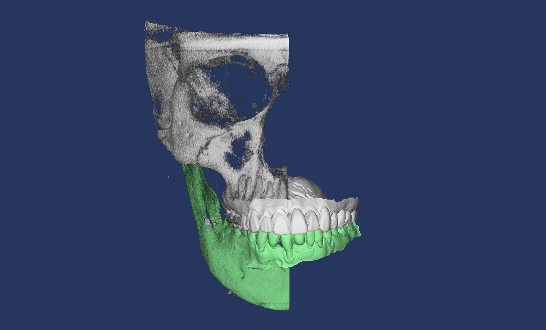 Models and CT Scans